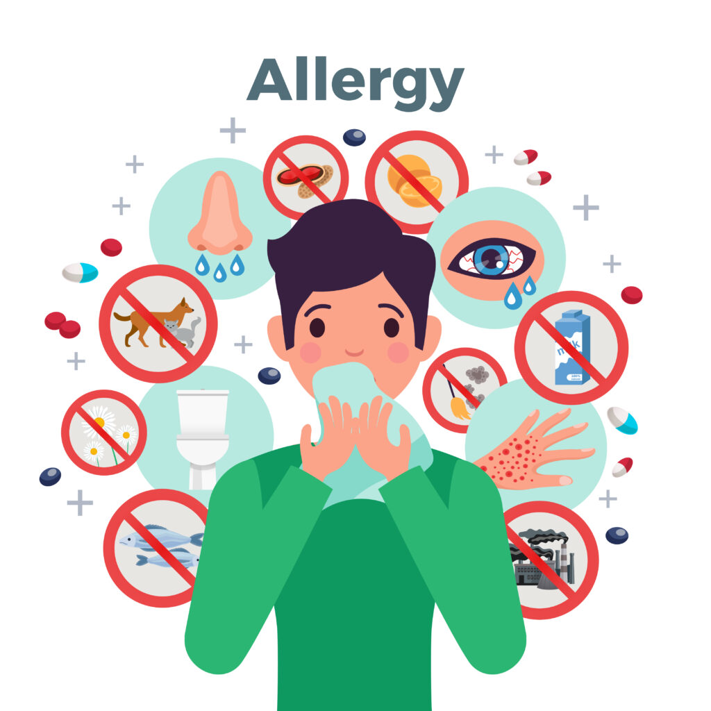 ALLERGY 30168 1024x1024